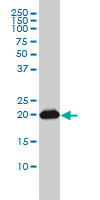RAP2B Antibody - RAP2B monoclonal antibody (M01), clone 4F12-3C6 Western blot of RAP2B expression in A-431.
