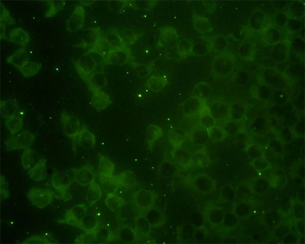 RAP2B Antibody - Immunofluorescence of monoclonal antibody to RAP2B on HeLa cell. [antibody concentration 10 ug/ml]