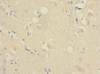 RAP2B Antibody - Immunohistochemistry of paraffin-embedded human brain tissue at dilution 1:100