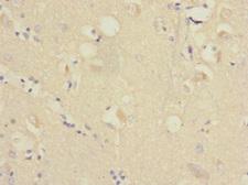 RAP2B Antibody - Immunohistochemistry of paraffin-embedded human brain tissue at dilution 1:100