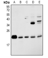 RAP2B Antibody - Western blot analysis of RAP2B expression in K562 (A), Jurkat (B), THP1 (C), BV2 (D), PMVEC (E) whole cell lysates.