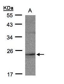 RAP2C Antibody - Sample (30 ug whole cell lysate). A: MOLT4 . 12% SDS PAGE. RAP2C antibody diluted at 1:500