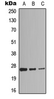 RAP2C Antibody - Western blot analysis of RAP2C expression in HEK293T (A); HepG2 (B); HeLa (C) whole cell lysates.