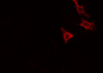 RAP2C Antibody - Staining HeLa cells by IF/ICC. The samples were fixed with PFA and permeabilized in 0.1% Triton X-100, then blocked in 10% serum for 45 min at 25°C. The primary antibody was diluted at 1:200 and incubated with the sample for 1 hour at 37°C. An Alexa Fluor 594 conjugated goat anti-rabbit IgG (H+L) antibody, diluted at 1/600, was used as secondary antibody.