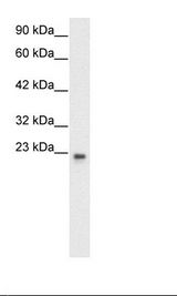 RAP30 / GTF2F2 Antibody - HepG2 Cell Lysate.  This image was taken for the unconjugated form of this product. Other forms have not been tested.