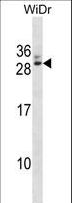 RAP30 / GTF2F2 Antibody - GTF2F2 Antibody western blot of WiDr cell line lysates (35 ug/lane). The GTF2F2 antibody detected the GTF2F2 protein (arrow).