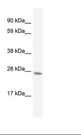 RAP30 / GTF2F2 Antibody - Fetal Liver Lysate.  This image was taken for the unconjugated form of this product. Other forms have not been tested.