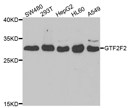 RAP30 / GTF2F2 Antibody - Western blot analysis of extracts of various cell lines.