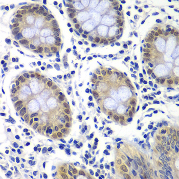 RAP30 / GTF2F2 Antibody - Immunohistochemistry of paraffin-embedded human colon tissue.