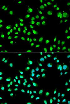 RAP30 / GTF2F2 Antibody - Immunofluorescence analysis of A549 cells.