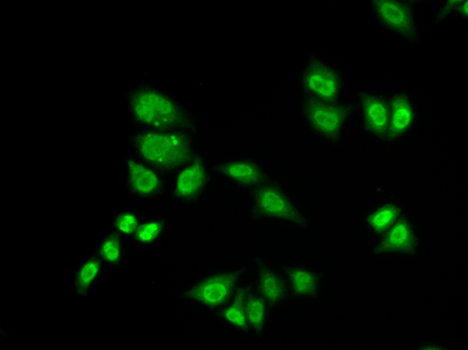 RAP30 / GTF2F2 Antibody - Immunofluorescence analysis of A549 cells.