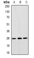 RAP30 / GTF2F2 Antibody - Western blot analysis of TFIIF RAP 30 expression in SW480 (A); HepG2 (B); A549 (C) whole cell lysates.