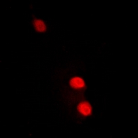 RAP30 / GTF2F2 Antibody - Immunofluorescent analysis of TFIIF RAP 30 staining in A549 cells. Formalin-fixed cells were permeabilized with 0.1% Triton X-100 in TBS for 5-10 minutes and blocked with 3% BSA-PBS for 30 minutes at room temperature. Cells were probed with the primary antibody in 3% BSA-PBS and incubated overnight at 4 deg C in a humidified chamber. Cells were washed with PBST and incubated with a DyLight 594-conjugated secondary antibody (red) in PBS at room temperature in the dark.