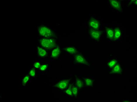 RAP30 / GTF2F2 Antibody - Immunofluorescence analysis of A549 cells using GTF2F2 antibody.