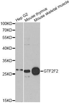 RAP30 / GTF2F2 Antibody - Western blot analysis of extracts of various cell lines, using GTF2F2 antibody at 1:1000 dilution. The secondary antibody used was an HRP Goat Anti-Rabbit IgG (H+L) at 1:10000 dilution. Lysates were loaded 25ug per lane and 3% nonfat dry milk in TBST was used for blocking. An ECL Kit was used for detection and the exposure time was 30s.