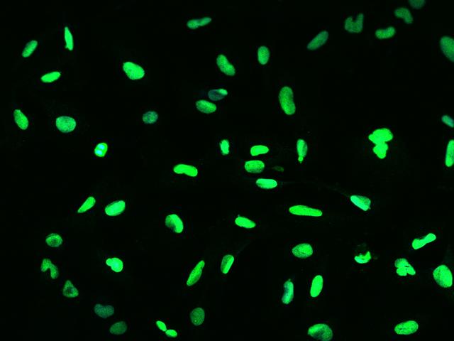 RAP30 / GTF2F2 Antibody - Immunofluorescence staining of GTF2F2 in U251MG cells. Cells were fixed with 4% PFA, permeabilzed with 0.1% Triton X-100 in PBS, blocked with 10% serum, and incubated with rabbit anti-Human GTF2F2 polyclonal antibody (dilution ratio 1:200) at 4°C overnight. Then cells were stained with the Alexa Fluor 488-conjugated Goat Anti-rabbit IgG secondary antibody (green). Positive staining was localized to Nucleus.