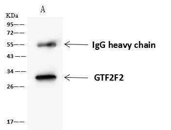 RAP30 / GTF2F2 Antibody - GTF2F2 was immunoprecipitated using: Lane A: 0.5 mg HeLa Whole Cell Lysate. 4 uL anti-GTF2F2 rabbit polyclonal antibody and 60 ug of Immunomagnetic beads Protein A/G. Primary antibody: Anti-GTF2F2 rabbit polyclonal antibody, at 1:100 dilution. Secondary antibody: Goat Anti-Rabbit IgG (H+L)/HRP at 1/10000 dilution. Developed using the ECL technique. Performed under reducing conditions. Predicted band size: 28 kDa. Observed band size: 30 kDa.