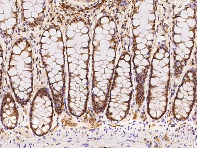 RAP30 / GTF2F2 Antibody - Immunochemical staining of human GTF2F2 in human rectum with rabbit polyclonal antibody at 1:100 dilution, formalin-fixed paraffin embedded sections.