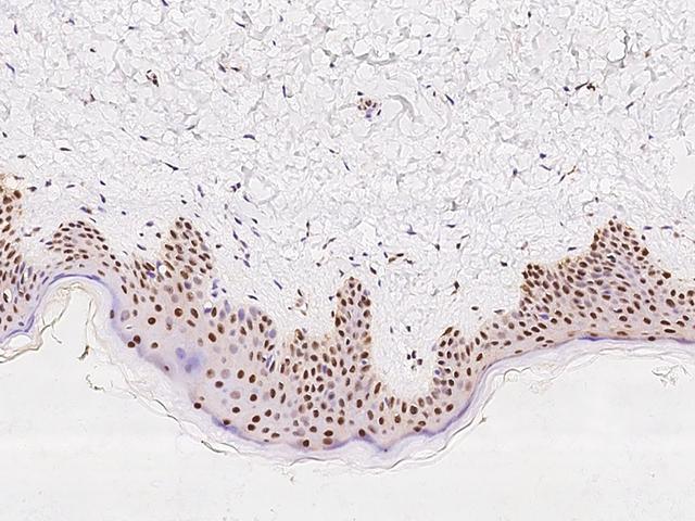 RAP30 / GTF2F2 Antibody - Immunochemical staining of human GTF2F2 in human skin with rabbit polyclonal antibody at 1:100 dilution, formalin-fixed paraffin embedded sections.