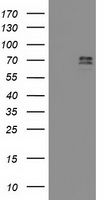 RAP74 / GTF2F1 Antibody - HEK293T cells were transfected with the pCMV6-ENTRY control (Left lane) or pCMV6-ENTRY GTF2F1 (Right lane) cDNA for 48 hrs and lysed. Equivalent amounts of cell lysates (5 ug per lane) were separated by SDS-PAGE and immunoblotted with anti-GTF2F1.