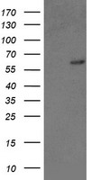 RAP74 / GTF2F1 Antibody - HEK293T cells were transfected with the pCMV6-ENTRY control (Left lane) or pCMV6-ENTRY GTF2F1 (Right lane) cDNA for 48 hrs and lysed. Equivalent amounts of cell lysates (5 ug per lane) were separated by SDS-PAGE and immunoblotted with anti-GTF2F1.