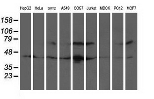 RAP74 / GTF2F1 Antibody - Western blot of extracts (35 ug) from 9 different cell lines by using anti-GTF2F1 monoclonal antibody.
