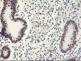RAP74 / GTF2F1 Antibody - IHC of paraffin-embedded Human endometrium tissue using anti-GTF2F1 mouse monoclonal antibody.
