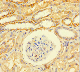 RAP74 / GTF2F1 Antibody - Immunohistochemistry of paraffin-embedded human kidney tissue at dilution of 1:100