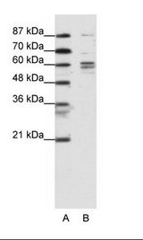 RAP74 / GTF2F1 Antibody - A: Marker, B: K562 Cell Lysate.  This image was taken for the unconjugated form of this product. Other forms have not been tested.