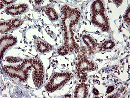 RAPGEF1 Antibody - IHC of paraffin-embedded Human breast tissue using anti-RAPGEF1 mouse monoclonal antibody. (Heat-induced epitope retrieval by 10mM citric buffer, pH6.0, 120°C for 3min).