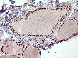 RAPGEF1 Antibody - IHC of paraffin-embedded Human thyroid tissue using anti-RAPGEF1 mouse monoclonal antibody. (Heat-induced epitope retrieval by 10mM citric buffer, pH6.0, 120°C for 3min).