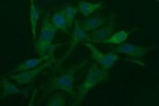RAPGEF1 Antibody - Immunofluorescent staining of HeLa cells using anti-RAPGEF1 mouse monoclonal antibody.