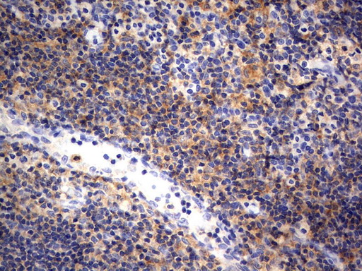 RAPGEF1 Antibody - Immunohistochemical staining of paraffin-embedded Human tonsil using anti-RAPGEF1mouse monoclonal antibody.  heat-induced epitope retrieval by 1 mM EDTA in 10mM Tris, pH8.0, 120C for 3min)