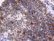 RAPGEF1 Antibody - Immunohistochemical staining of paraffin-embedded Human lymph node tissue using anti-RAPGEF1 mouse monoclonal antibody.  heat-induced epitope retrieval by 1 mM EDTA in 10mM Tris, pH8.0, 120C for 3min)