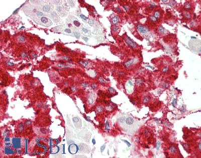 RAPGEF2 Antibody - Human Adrenal: Formalin-Fixed, Paraffin-Embedded (FFPE).  This image was taken for the unconjugated form of this product. Other forms have not been tested.