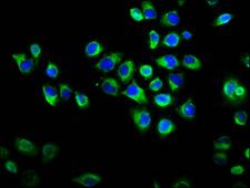 RAPGEF2 Antibody - Immunofluorescence staining of Hela cells diluted at 1:133, counter-stained with DAPI. The cells were fixed in 4% formaldehyde, permeabilized using 0.2% Triton X-100 and blocked in 10% normal Goat Serum. The cells were then incubated with the antibody overnight at 4°C.The Secondary antibody was Alexa Fluor 488-congugated AffiniPure Goat Anti-Rabbit IgG (H+L).