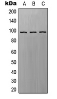RAPGEF3 / EPAC Antibody - Western blot analysis of EPAC1 expression in A549 (A); SP2/0 (B); H9C2 (C) whole cell lysates.