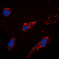 RAPGEF3 / EPAC Antibody - Immunofluorescent analysis of EPAC1 staining in A549 cells. Formalin-fixed cells were permeabilized with 0.1% Triton X-100 in TBS for 5-10 minutes and blocked with 3% BSA-PBS for 30 minutes at room temperature. Cells were probed with the primary antibody in 3% BSA-PBS and incubated overnight at 4 C in a humidified chamber. Cells were washed with PBST and incubated with a DyLight 594-conjugated secondary antibody (red) in PBS at room temperature in the dark. DAPI was used to stain the cell nuclei (blue).