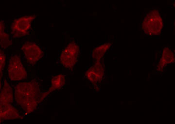 RAPGEF3 / EPAC Antibody - Staining HeLa cells by IF/ICC. The samples were fixed with PFA and permeabilized in 0.1% Triton X-100, then blocked in 10% serum for 45 min at 25°C. The primary antibody was diluted at 1:200 and incubated with the sample for 1 hour at 37°C. An Alexa Fluor 594 conjugated goat anti-rabbit IgG (H+L) Ab, diluted at 1/600, was used as the secondary antibody.