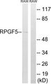 RAPGEF5 / GFR Antibody - Western blot analysis of lysates from RAW264.7 cells, using RAPGEF5 Antibody. The lane on the right is blocked with the synthesized peptide.