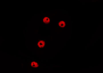 RAPGEF5 / GFR Antibody - Staining HepG2 cells by IF/ICC. The samples were fixed with PFA and permeabilized in 0.1% Triton X-100, then blocked in 10% serum for 45 min at 25°C. The primary antibody was diluted at 1:200 and incubated with the sample for 1 hour at 37°C. An Alexa Fluor 594 conjugated goat anti-rabbit IgG (H+L) Ab, diluted at 1/600, was used as the secondary antibody.