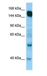 RAPGEF6 Antibody - RAPGEF6 antibody Western Blot of Fetal Brain.  This image was taken for the unconjugated form of this product. Other forms have not been tested.
