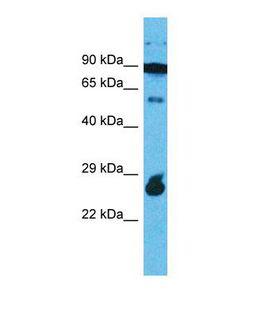 RAPGEFL1 Antibody - Western blot of Human 721_B. RAPGEFL1 antibody dilution 1.0 ug/ml.  This image was taken for the unconjugated form of this product. Other forms have not been tested.