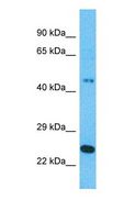RAPGEFL1 Antibody - Western blot of RAPGEFL1 Antibody with human 721_B Whole Cell lysate.  This image was taken for the unconjugated form of this product. Other forms have not been tested.