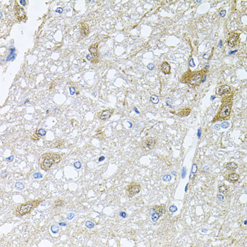 RAPSN Antibody - Immunohistochemistry of paraffin-embedded rat brain tissue.