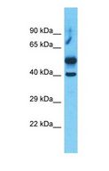 RAPSN Antibody - Western blot of RAPSN Antibody with human Uterus Tumor lysate.  This image was taken for the unconjugated form of this product. Other forms have not been tested.