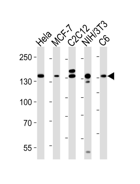 Raptor / Mip1 Antibody - Western blot of lysates from HeLa, MCF-7, mouse C2C12, mouse NIH/3T3, rat C6 cell line (from left to right) with RPTOR Antibody. Antibody was diluted at 1:1000 at each lane. A goat anti-rabbit IgG H&L (HRP) at 1:10000 dilution was used as the secondary antibody. Lysates at 20 ug per lane.
