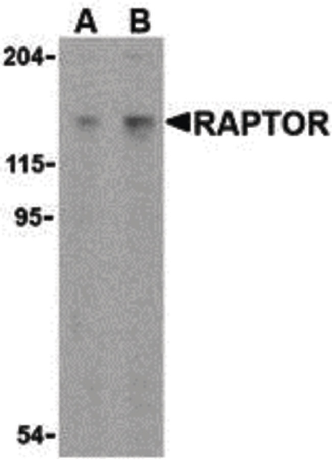 Raptor / Mip1 Antibody - Western blot of Raptor in L1210 cell lysate with Raptor antibody at (A) 2 and (B) 4 ug/ml.