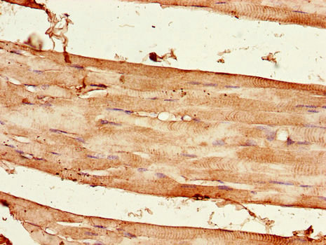 Raptor / Mip1 Antibody - Immunohistochemistry of paraffin-embedded human skeletal muscle tissue using RPTOR Antibody at dilution of 1:100