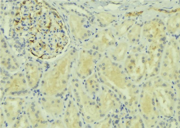 Raptor / Mip1 Antibody - 1:100 staining mouse kidney tissue by IHC-P. The sample was formaldehyde fixed and a heat mediated antigen retrieval step in citrate buffer was performed. The sample was then blocked and incubated with the antibody for 1.5 hours at 22°C. An HRP conjugated goat anti-rabbit antibody was used as the secondary.